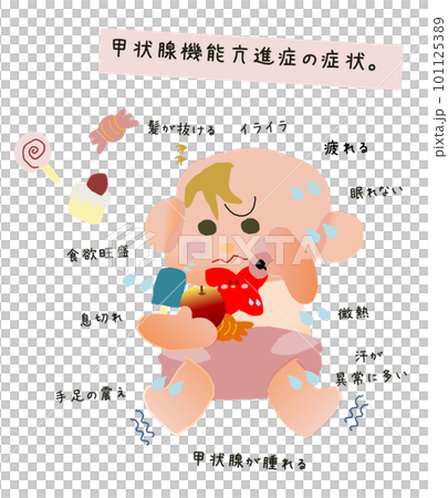 甲状腺機能亢進症　症状イラス 101125389
