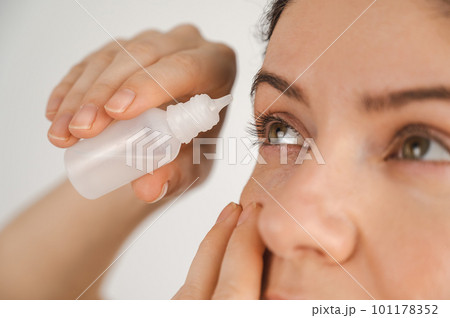 Caucasian woman dripping moisturizing drops into her eyes. Caucasian woman dripping moisturizing drops into her eyes. 101178352