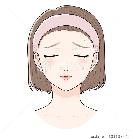 ほくろに悩むヘアバンドをつけた女性　首上 101187479