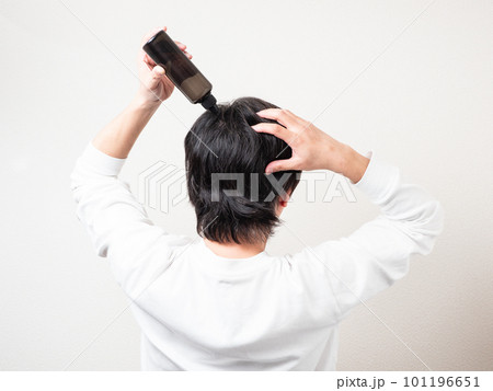 髪の毛に育毛剤を塗る男性の後ろ姿・スカルプケア 101196651