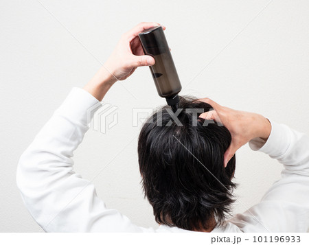 髪の毛に育毛剤を塗る男性の後ろ姿・スカルプケア 101196933