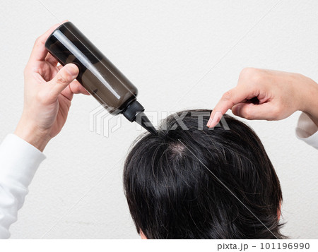 髪の毛に育毛剤を塗る男性の後ろ姿・スカルプケア 101196990