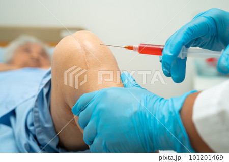 Asian doctor inject Hyaluronic acid platelet rich plasma into the knee of senior woman to walk without pain. Asian doctor inject Hyaluronic acid platelet rich plasma into the knee of senior woman to walk without pain. 101201469