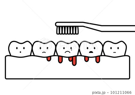 gingivitis or scurvy, brushing teeth with bleeding on gum and tooth - dental cartoon vector outline flat style 101211066