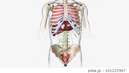 The Bladder Cancer, Stage IV The Bladder Cancer, Stage IV 101225907