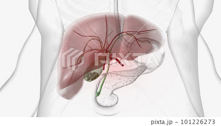Gallstones are pieces of solid material that form in the gallbladder, a small hollow organ located beneath the liver. 101226273