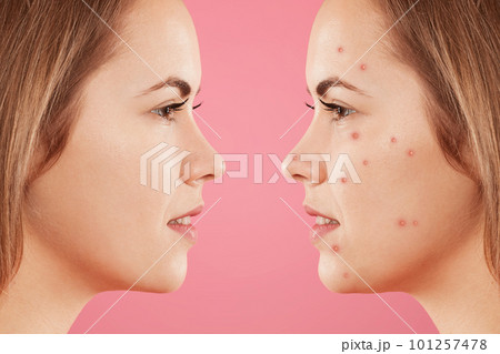 Sideways shot of two female`s faces Sideways shot of two female`s faces 101257478