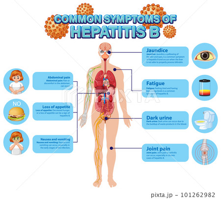 Informative poster of common symptoms Hepatitis B Informative poster of common symptoms Hepatitis B 101262982