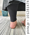 扁平足の女性 101281474