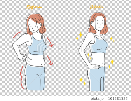 Before after illustration material of a woman who succeeded in dieting Before after illustration material of a woman who succeeded in dieting 101281525