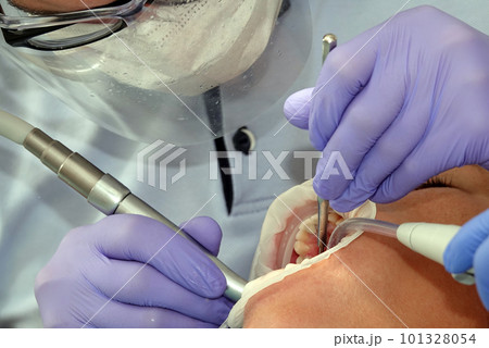 Kiev, Ukraine August 22, 2020: Dentist doctor works with a patient close-up Kiev, Ukraine August 22, 2020: Dentist doctor works with a patient close-up 101328054