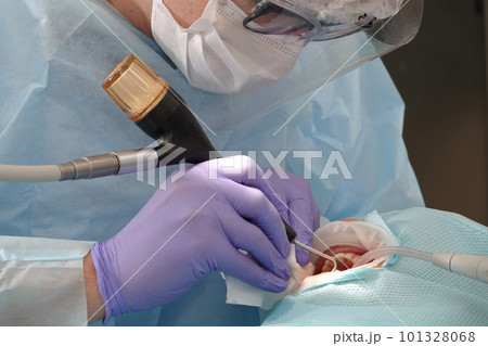 Kiev, Ukraine August 22, 2020: Dentist doctor works with a patient close-up 101328068