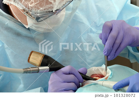 Kiev, Ukraine August 22, 2020: Dentist doctor works with a patient close-up 101328072