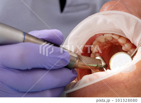 Kiev, Ukraine August 22, 2020: Dentist doctor works with a patient close-up Kiev, Ukraine August 22, 2020: Dentist doctor works with a patient close-up 101328080