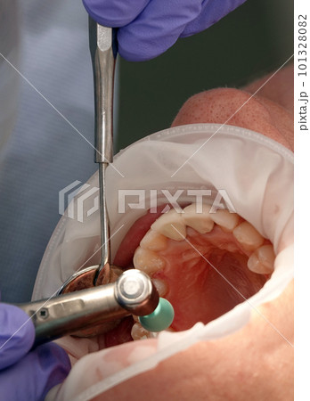 Kiev, Ukraine August 22, 2020: Dentist doctor works with a patient close-up 101328082