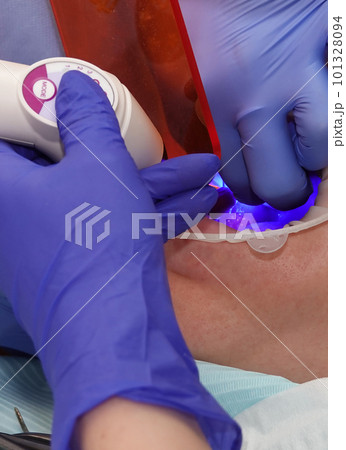 Kiev, Ukraine August 22, 2020: Dentist doctor works with a patient close-up Kiev, Ukraine August 22, 2020: Dentist doctor works with a patient close-up 101328094