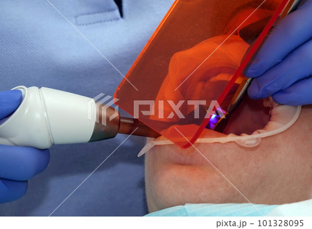 Kiev, Ukraine August 22, 2020: Dentist doctor works with a patient close-up 101328095