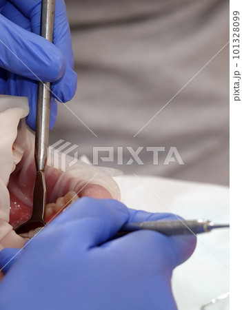 Kiev, Ukraine August 22, 2020: Dentist doctor's tool close up 101328099