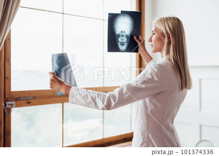Woman radiologist looking at scans of skull. Woman radiologist looking at scans of skull. 101374336