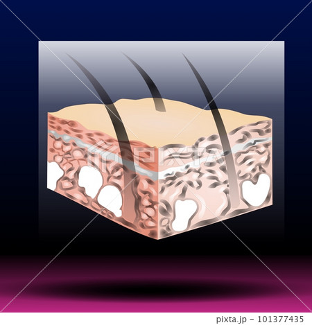 Skin anatomy. Human normal skin dermis epidermis adipose layers recent vector biological infographic. 101377435