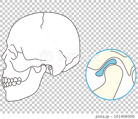 Normal jaw joint disc temporomandibular joint disorder 101406000