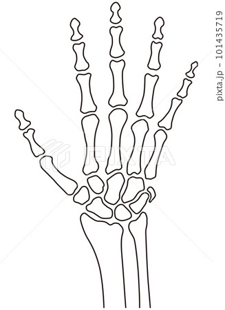 手の骨格　医療　ケガ　人体模型 101435719