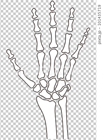 手の骨格　医療　ケガ　人体模型 101435719