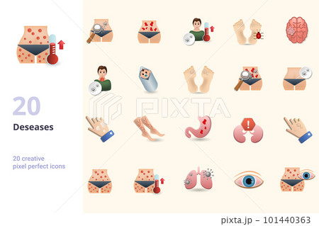 Deseases set. Creative icons: typhoid fever, urticaria, viral fever, tungiasis, tumor, tularemia, warkany syndrome, warts, yersiniosis, yeast infection, vitiligo, varicose, ulcers, uremia, warts 101440363