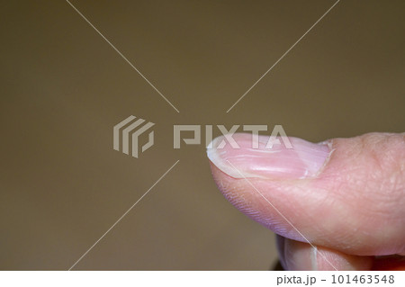 波板状爪（洗濯板状爪） 101463548