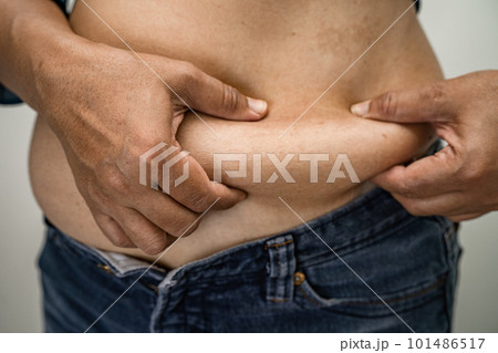 Overweight Asian woman show and use hand to squeeze fat belly. Overweight Asian woman show and use hand to squeeze fat belly. 101486517
