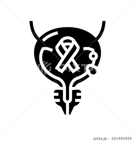 bladder cancer glyph icon vector illustration bladder cancer glyph icon vector illustration 101493934