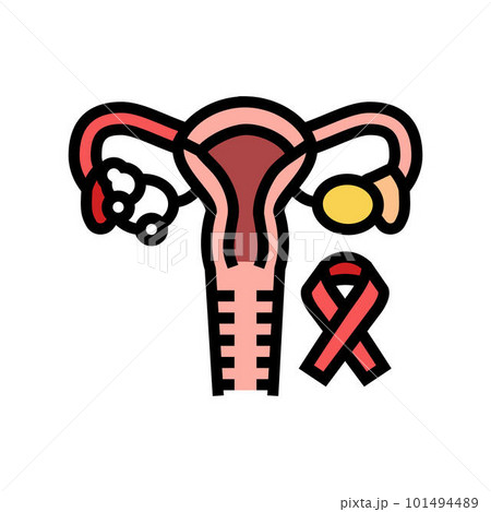 endometrial cancer color icon vector illustration 101494489