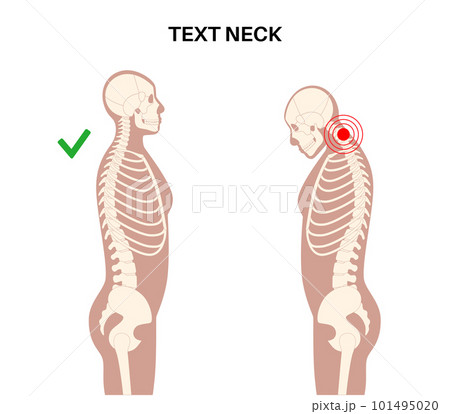 Neck vertebrae deformity 101495020