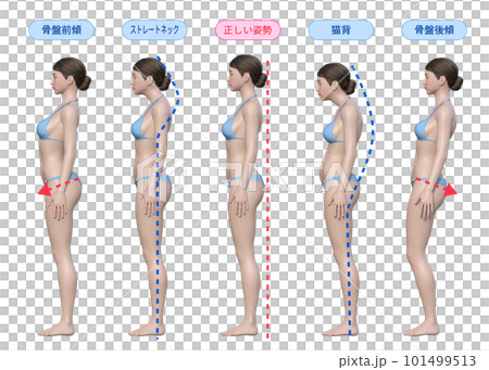 正しい姿勢 猫背 ストレートネック 骨盤後傾 骨盤前傾の3dモデル女性の横向き 正しい姿勢 猫背 ストレートネック 骨盤後傾 骨盤前傾の3dモデル女性の横向き 101499513