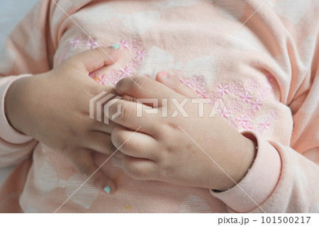child hand suffering from itching skin  101500217