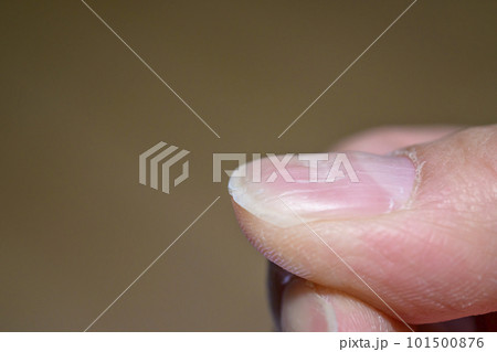 波板状爪（洗濯板状爪） 101500876