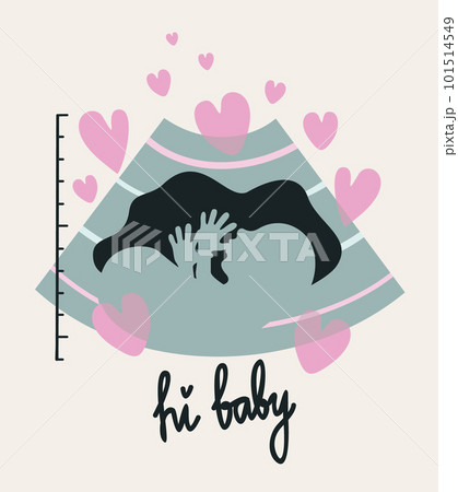 Prenatal ultrasound. Vector illustration with hearts and lettering isolated on light beige background. 101514549