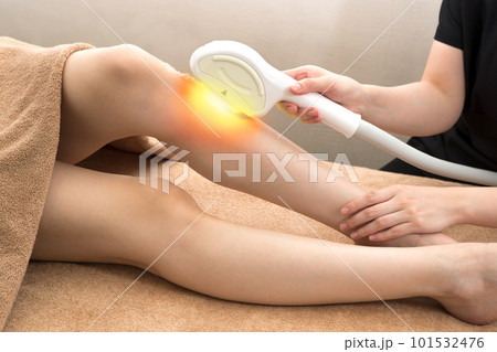 エステ・脚の脱毛	 101532476