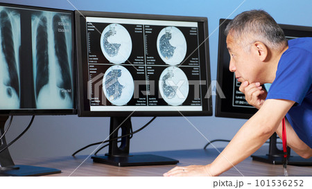モニターに表示したエックス線データを読影するスクラブ着用の男性 モニターに表示したエックス線データを読影するスクラブ着用の男性 101536252