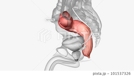 The last two sections of the large intestine, or colon, are the sigmoid colon and rectum. 101537326