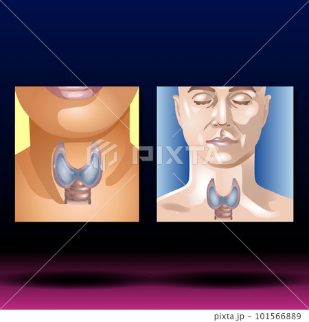Thyroid Gland 101566889