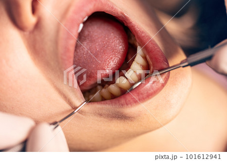 Dentist examining teeth Dentist examining teeth 101612941