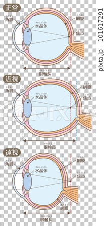 眼睛的結構_視力（近視/遠視） 101617291