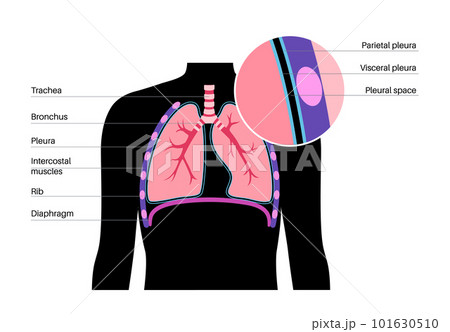 Pleura anatomical poster 101630510