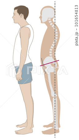 反り腰、猫背の姿勢で立つ横向きの男性と骨格 101654813