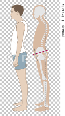 反り腰、猫背の姿勢で立つ横向きの男性と骨格 101654813