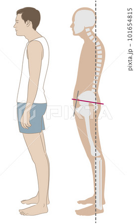 猫背、スウェイバックの姿勢で立つ横向きの男性と骨格 101654815