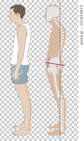 猫背、スウェイバックの姿勢で立つ横向きの男性と骨格 101654815