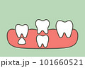 teeth are growing up from the gum by permanent tooth located below primary tooth, first tooth - dental cartoon vector flat style 101660521