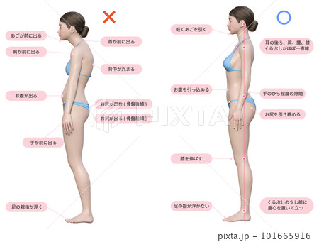 水色の水着を着た猫背の3dモデルの女性と正しい姿勢の女性のセット 101665916